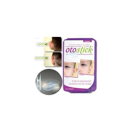 Otostick® Correcteur esthétique d'oreilles pour bébé : : Bébé et  Puériculture